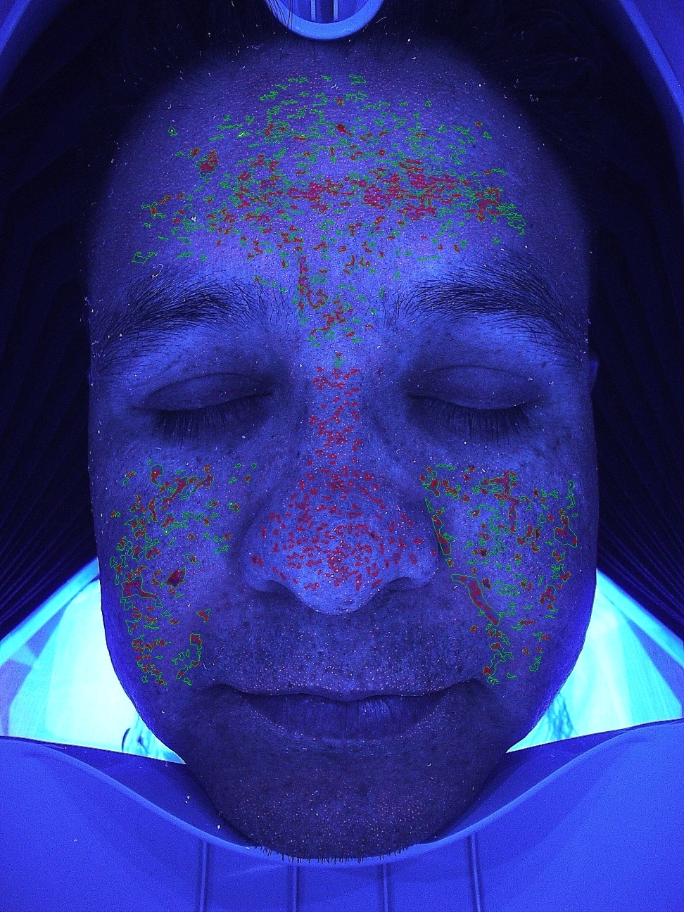 Magic Mirror galería 15